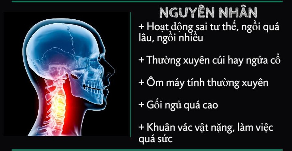 Thoái hóa đốt sống cổ và những điều cần biết  - Ảnh 2.