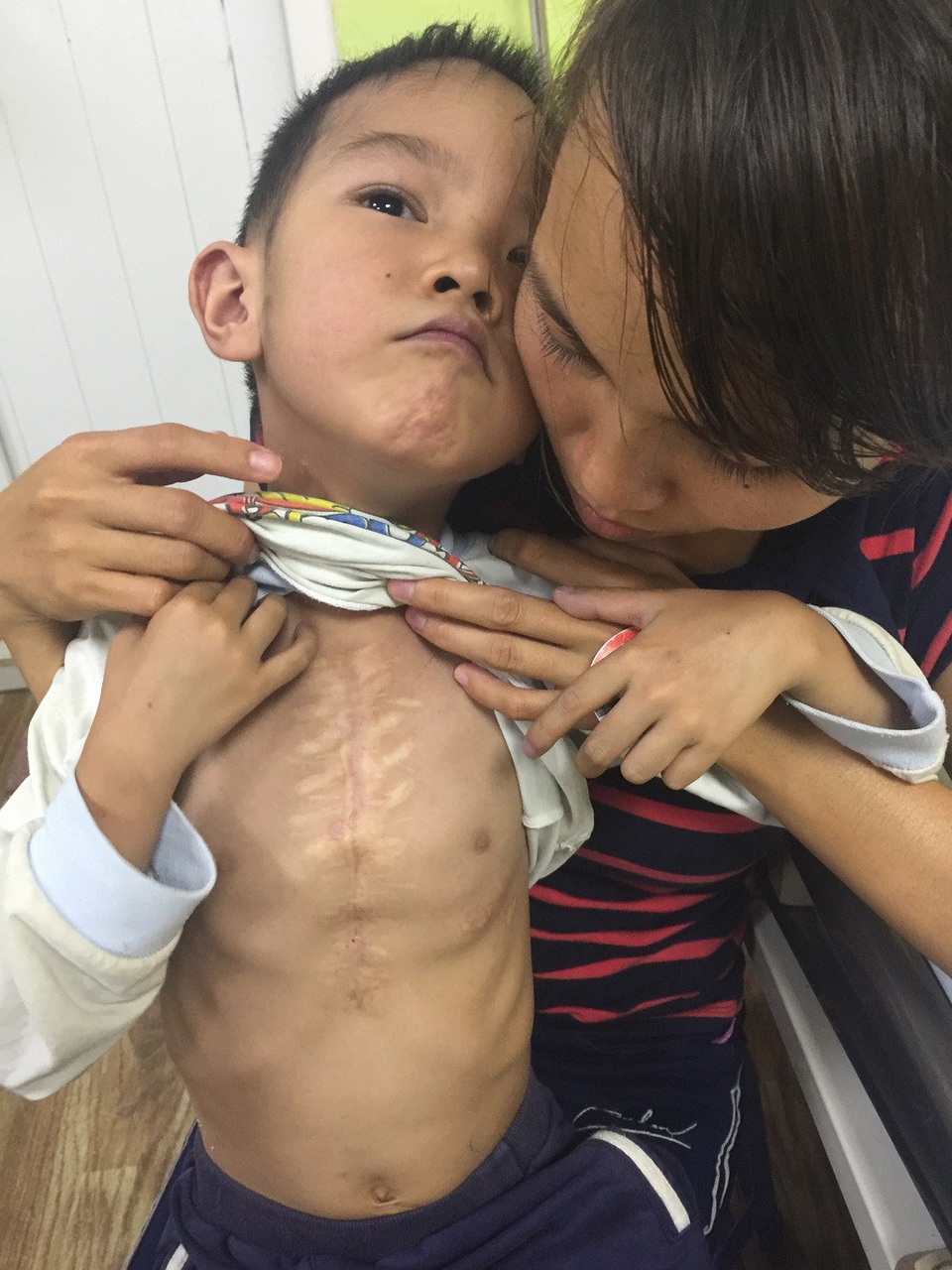 4 lần mổ tim, cậu bé đang đứng trước ca mổ lần thứ 5.