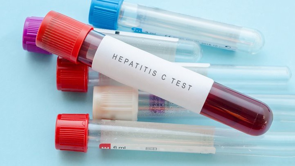 5 loại xét nghiệm nhất định bạn phải biết - 3 5 loại xét nghiệm nhất định bạn phải biết - 3