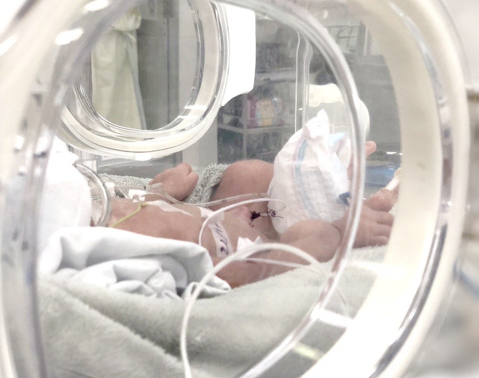 Bé gái 4kg bị ngạt, liệt cánh tay sau sinh thường - 1 Bệnh nhi đang được chăm sóc tích cực tại khoa Hồi sức Sơ sinh