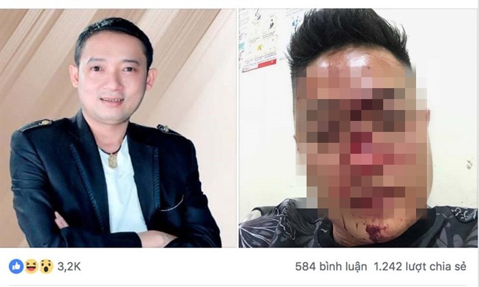 Danh hài Chiến Thắng từng bị tố đánh người hâm mộ dẫn đến thương tích.