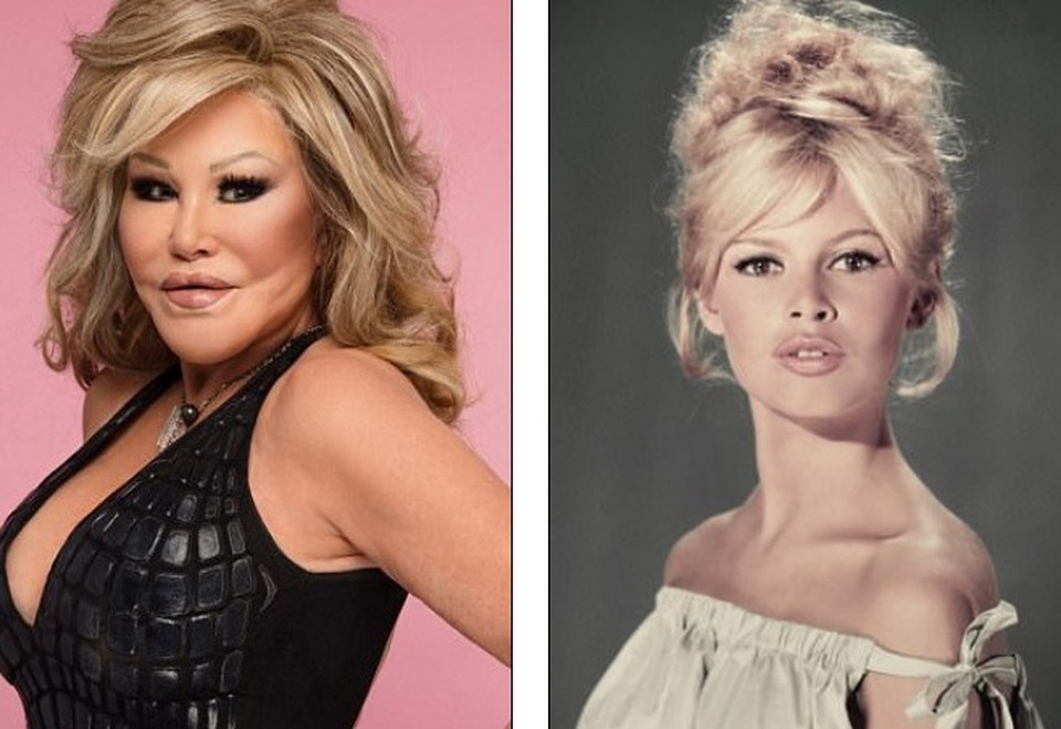 
Lloyd Klein thậm chí nói rằng mỗi khi Jocelyn Wildenstein vào nhà hàng, mọi người thường nghĩ bà là nữ minh tinh Brigitte Bardot
