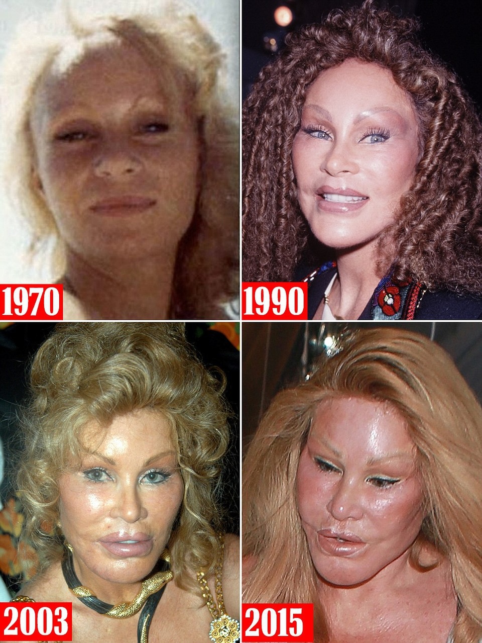 
Gương mặt của Jocelyn Wildenstein đã thay đổi rất nhiều trong vài chục năm qua nhưng bà khẳng định, ngày xưa hiển nhiên bà trẻ đẹp hơn nhưng bây giờ cũng không dao kéo
