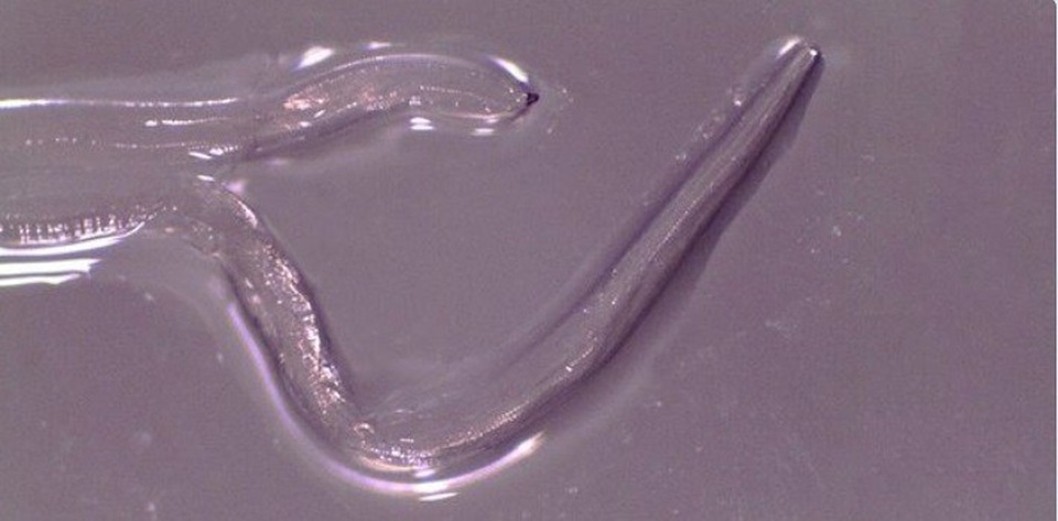 Bác sỹ lấy 14 con sán Thelazia từ trong mắt cô gái Mỹ - 2 Bác sỹ lấy 14 con sán Thelazia từ trong mắt cô gái Mỹ - 2