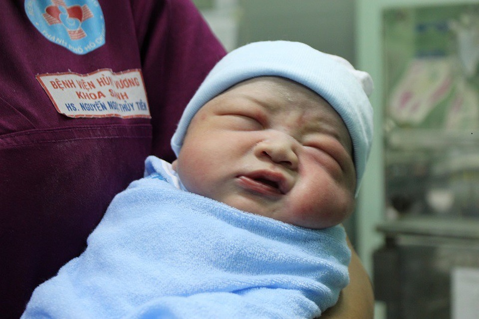 Khoảnh khắc “thiên thần” đầu tiên của năm Mậu Tuất chào đời - 2 Người mẹ dũng cảm đã cho ra đời công dân đầu tiên của năm 2018 tại Bệnh viện Hùng Vương