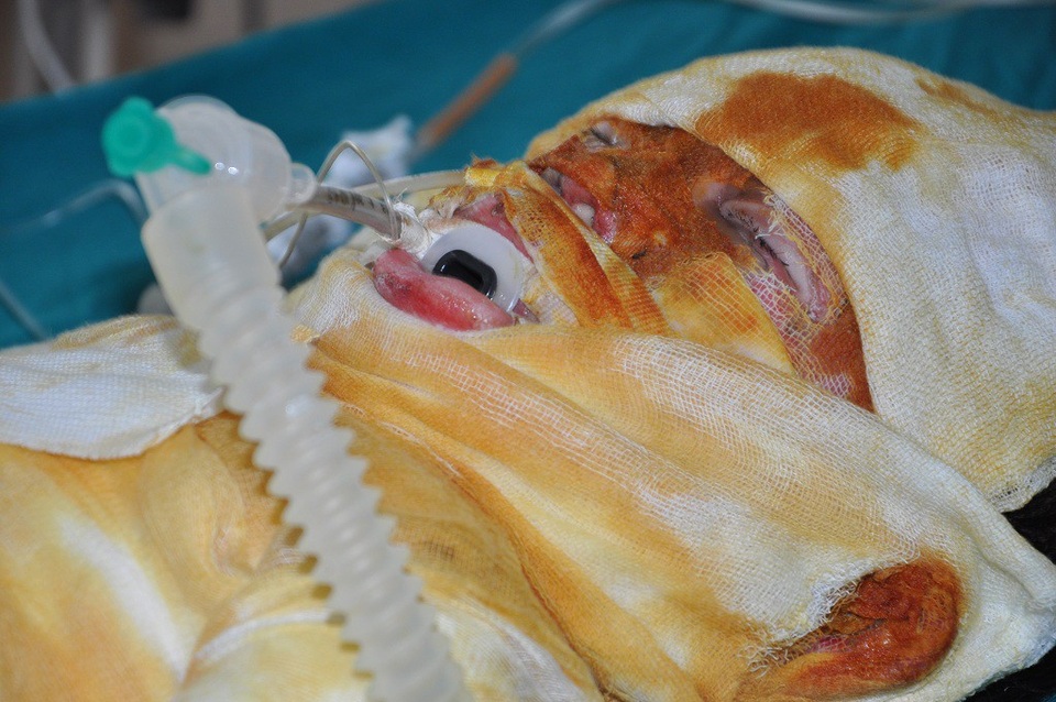 Tính mạng của em đang như ngọn đèn trước gió nếu như không được ai giúp đỡ.