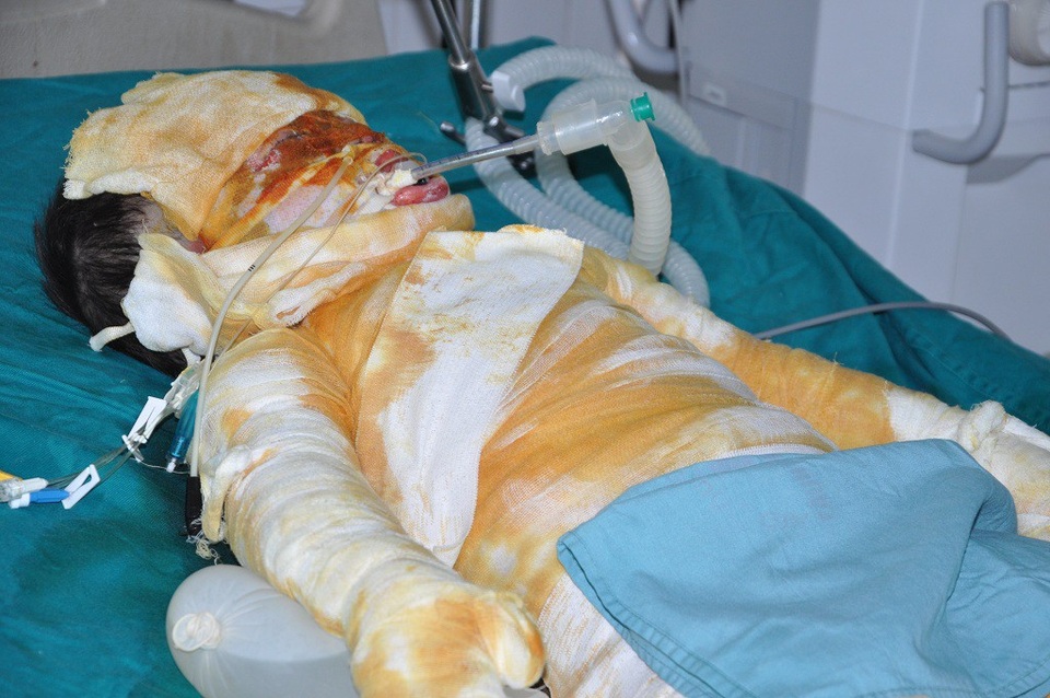 Để cứu tính mạng của bé, mỗi ngày em phải sử dụng thuốc từ 7-10 triệu đồng.