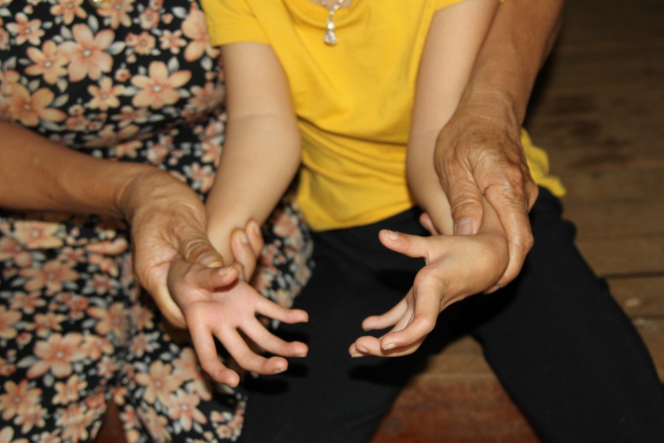 “Con ước mình không bệnh để bố mẹ không bỏ đi ! ” - 3 Càng lớn, chân tay càng co quắp, không thể cầm nắm đi lại