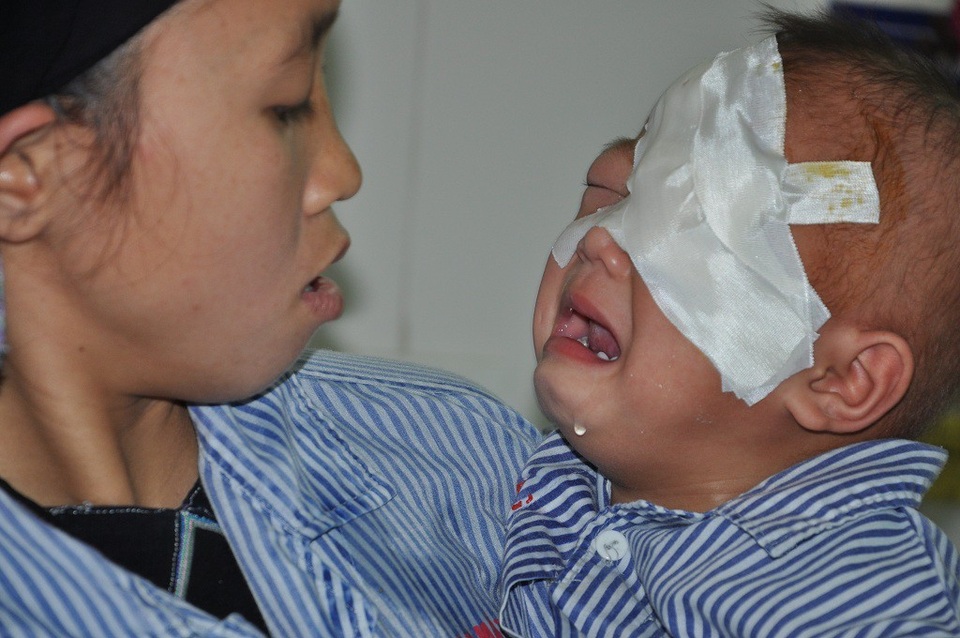 Tiếng khóc xé lòng của bé 2 tuổi bị ung thư võng mạc - 2 Nước mắt giàn giụa vì đau và vì hoảng khi 1 mắt không còn.