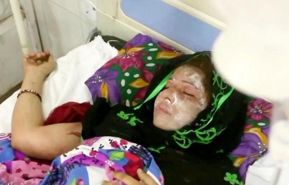 Dã man chồng đổ axit vào mặt vợ trong lúc ngủ - 2 Farah không thể ngờ là người chồng 32 tuổi lại có thể đối xử như thế với mình