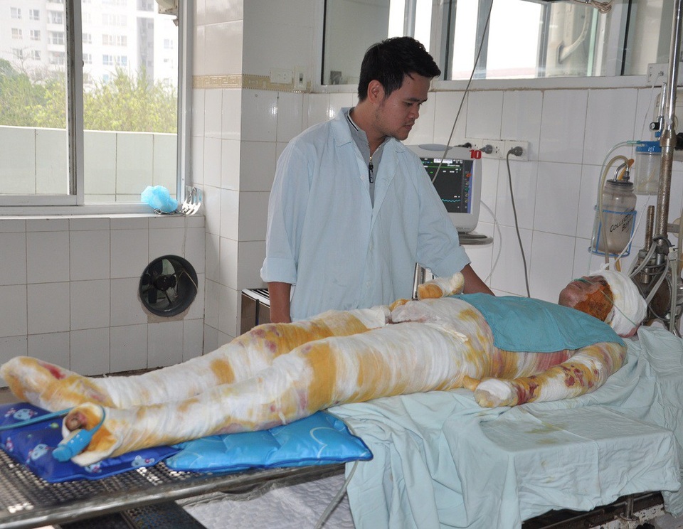 Nổ gas kinh hoàng, người mẹ trẻ nguy kịch tính mạng - 1 Bị bỏng gas 61% cơ thể trong đó có 51% bỏng sâu khiến cho Hương rơi vào tình trạng nguy kịch.