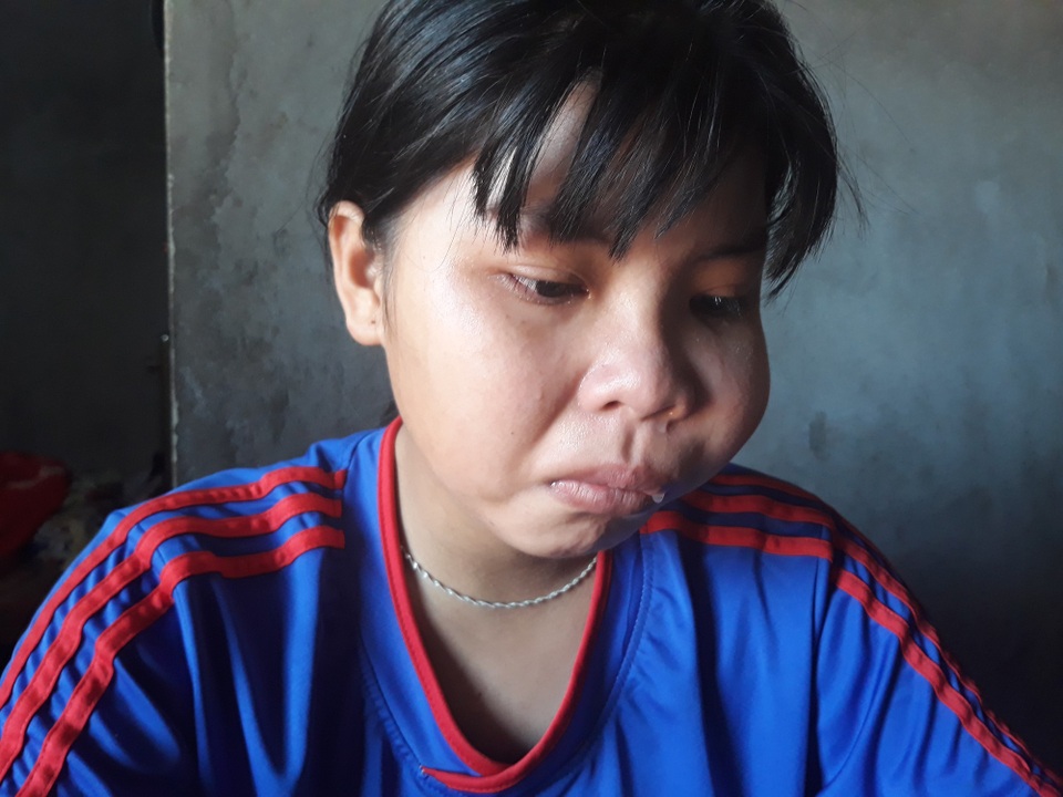 Nữ sinh 8 năm chống chọi với bệnh tật mong có tiền phẫu thuật khối u trên mặt - 1 Ngoài căn bệnh bạch cầu tủy cấp, Hằng còn bị khối bướu máu hành hạ khiến em không thể nhai thức ăn, việc nói chuyện rất khó khăn