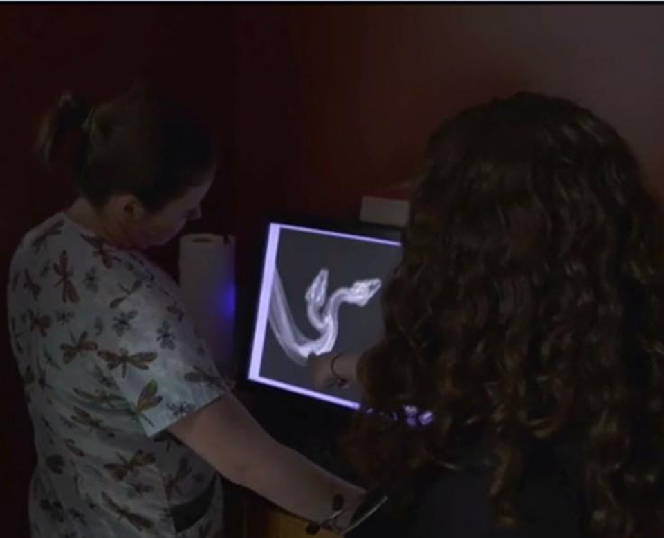 Tiếp tục trải qua chụp X quang