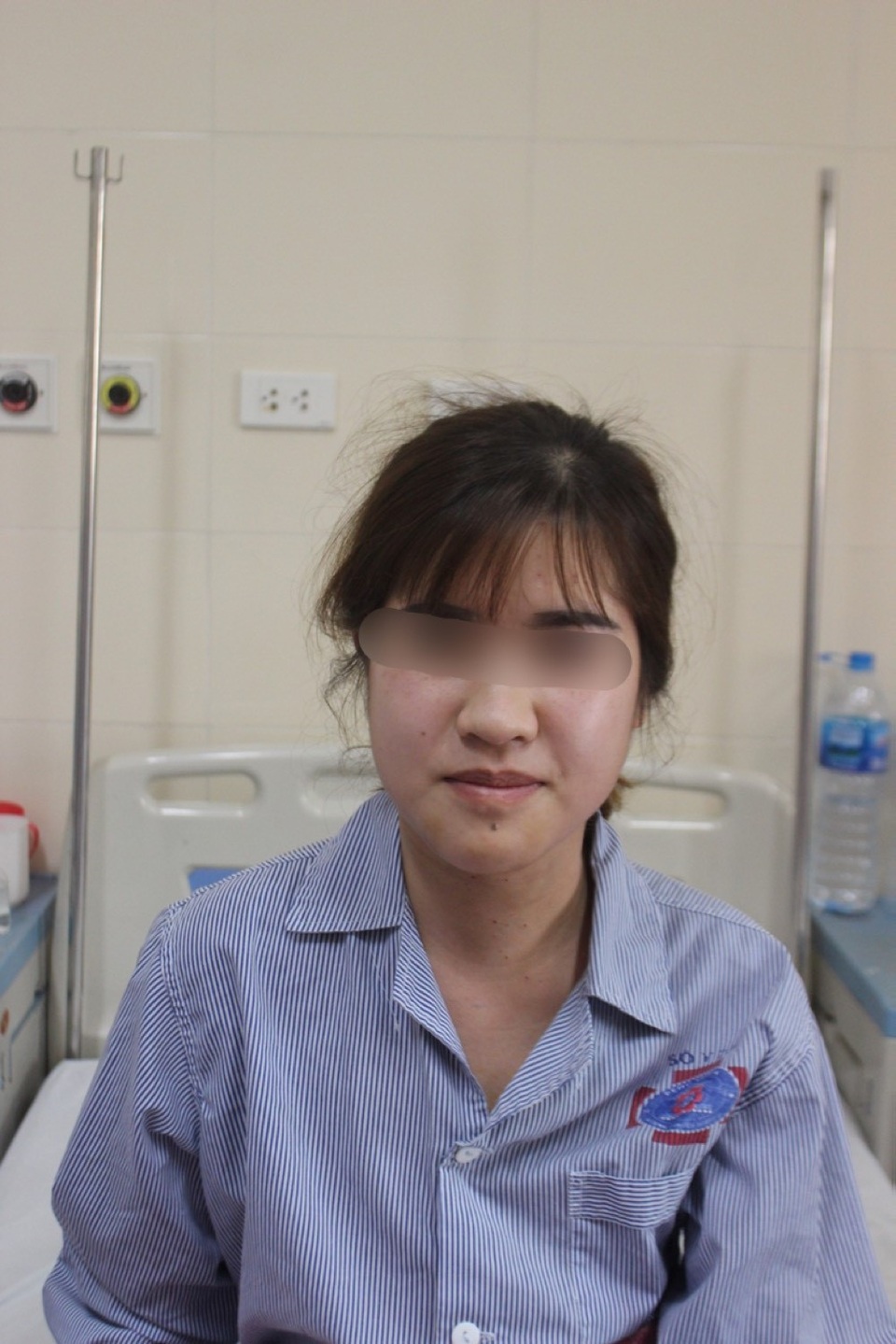 Nữ bệnh nhân 19 tuổi được cắt u tuyến giáp qua đường miệng - 1 Bệnh nhân hồi phục một ngày sau phẫu thuật, không có vết sẹo vùng cổ.
