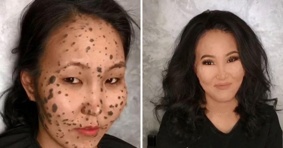 "Phù thủy" trang điểm biến khuôn mặt đầy vết bớt trở nên vô cùng xinh đẹp - 1 Sau khi trang điểm, Irina như trở thành một người hoàn toàn khác
