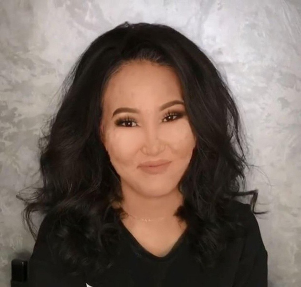 "Phù thủy" trang điểm biến khuôn mặt đầy vết bớt trở nên vô cùng xinh đẹp - 3 Cô gái trở nên xinh đẹp một cách bất ngờ