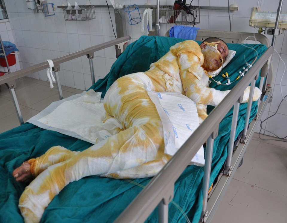 Lao vào cứu bạn, cô gái trẻ bị đốt cháy như ngọn đuốc - 1 Lao vào cứu bạn, Mơ bị đốt cháy như ngọn đuốc.