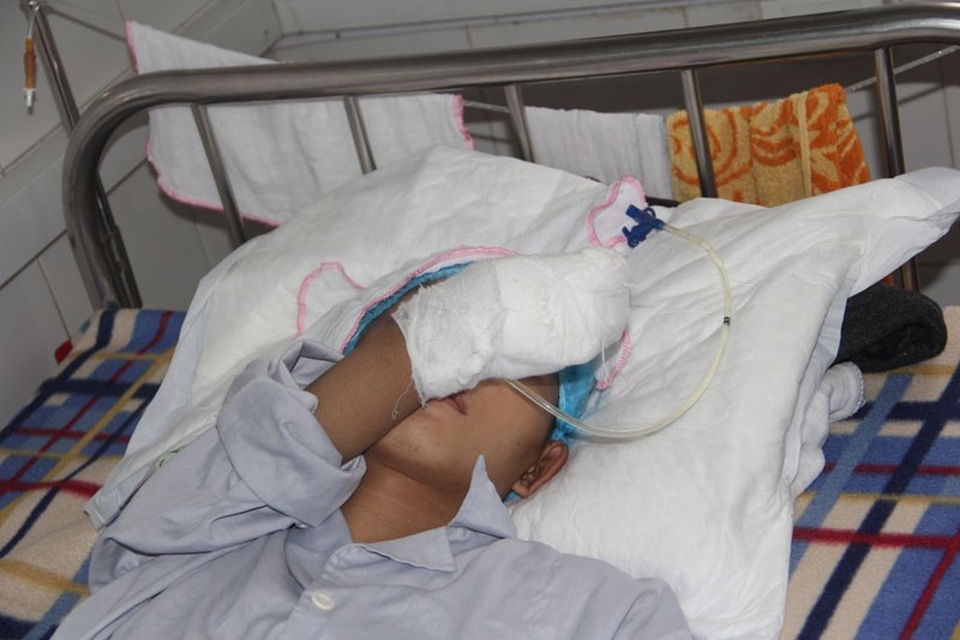 Bị bỏng điện cao thế, chàng trai trẻ mất đôi tay, nguy cơ liệt nửa người - 4 Em cố lảng tránh đi vì không còn tinh thần, sức lực để chuyện trò