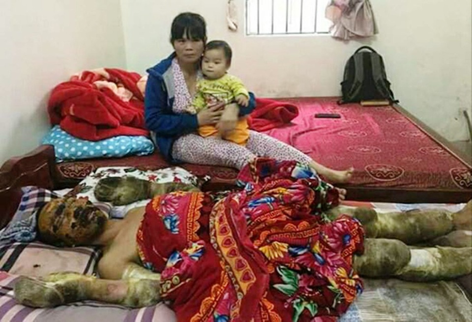 Đau đớn 2 phận người bỏng nặng nguy kịch trên giường bệnh - 4 Chị Sơn phải bế con nhỏ đi chăm sóc chồng tại bệnh viện.