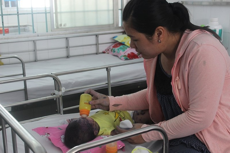 Mẹ mắc thủy đậu có được cho con bú? - 2 Bé Y. bệnh khi 21 ngày tuổi. Ảnh: HL