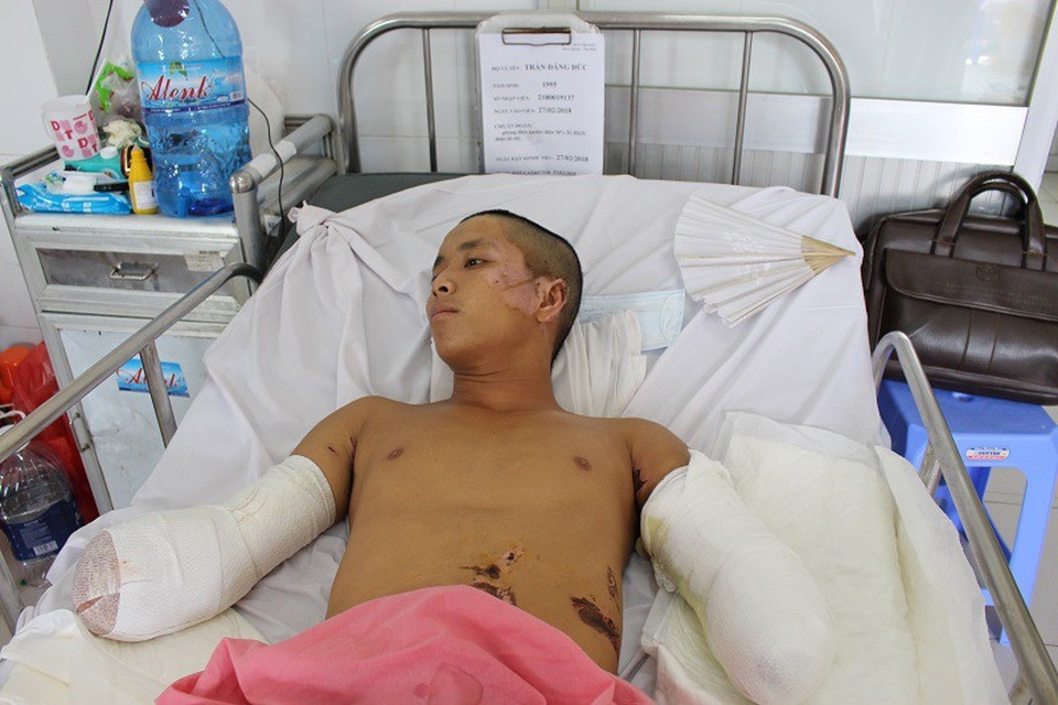 Tai nạn bỏng điện thường xảy ra ở nhóm người trẻ, trong độ tuổi lao động