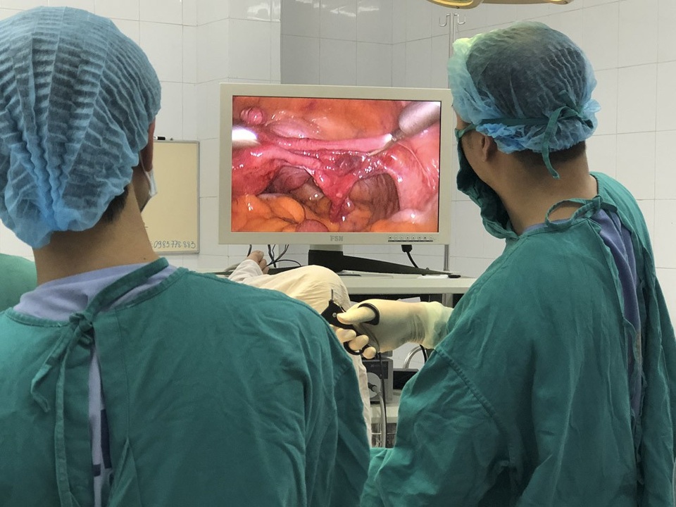 Phẫu thuật nội soi cắt tử cung hoàn toàn và hai phần phụ bằng dao siêu âm cho bệnh nhân Đinh Thị V. (60 tuổi).