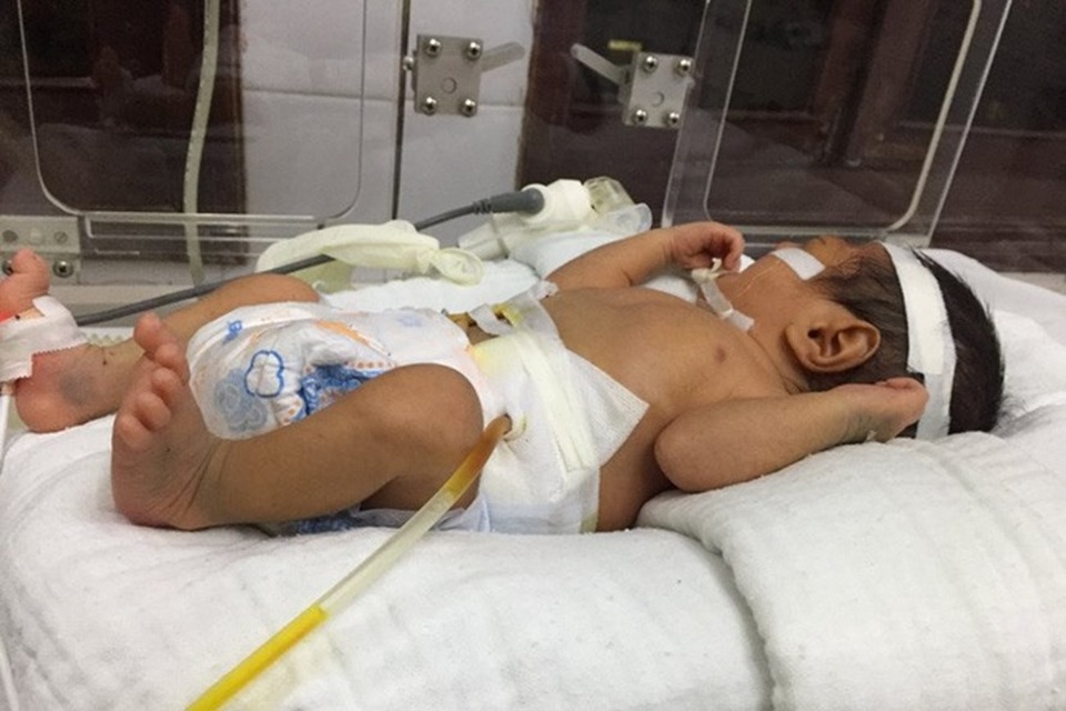 Hy hữu: Bé sơ sinh 2 ngày tuổi bị vỡ dạ dày - 1