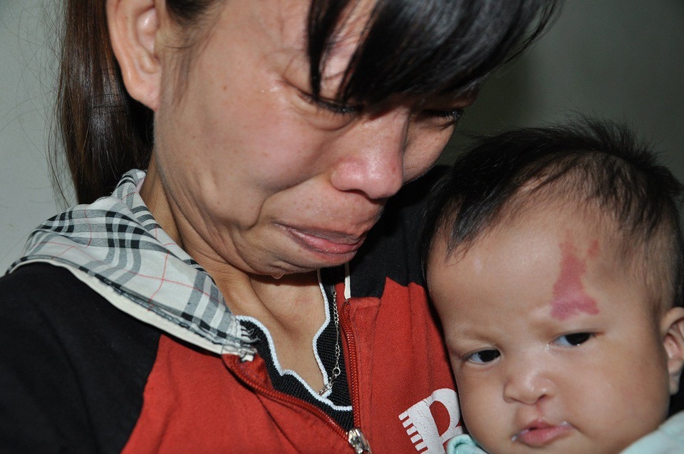 Mẹ khóc nghẹn ôm con 7 tháng tuổi bị tim và dị tật môi - 6 Tiếp tới em sẽ còn phải trải qua nhiều cuộc phẫu thuật nữa mà gia đình cùng đường.