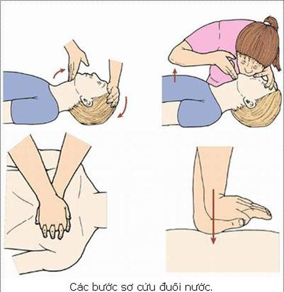 Bé trai đuối nước được cứu sống nhờ cha kiên trì thổi ngạt - 1 Sơ cứu ban đầu rất quan trọng, tăng cơ hội sống cho người bị ngạt nước. Ảnh internet.