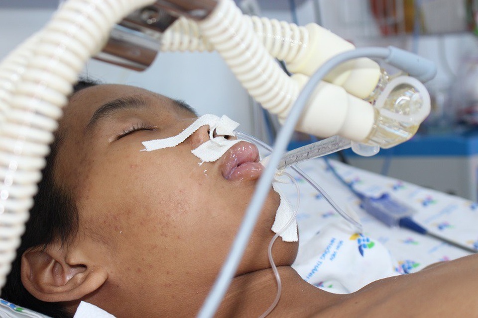 Bé trai thập tử nhất sinh trong cảnh gia đình khánh kiệt - 1 Chức năng hô hấp mất hoàn toàn, cậu bé phải lệ thuộc vào máy thở