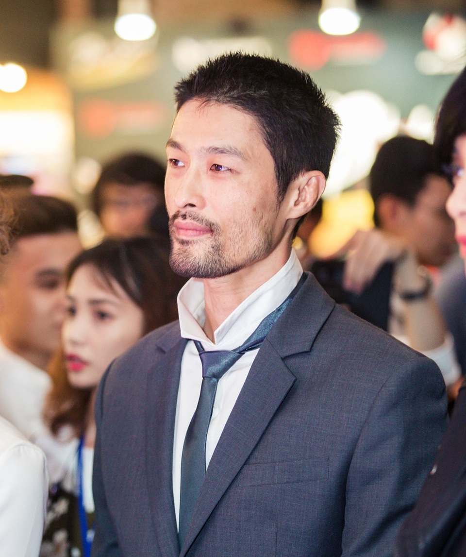 Hình ảnh gần đây của Johnny Trí Nguyễn khiến khá nhiều người nhạc nhiên vì quá khác so với vẻ điển trai, phong độ trước đây.