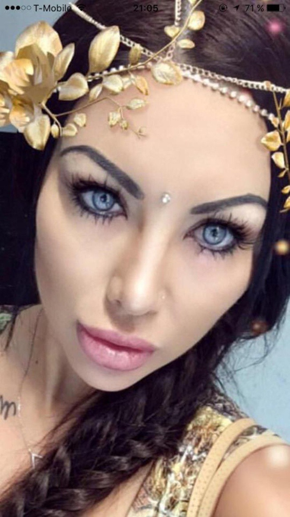 Phẫu thuật đổi màu mắt, hot girl suýt mù - 1 Sau phẫu thuật, Nadinne có thị lực của một cụ già 90 tuổi