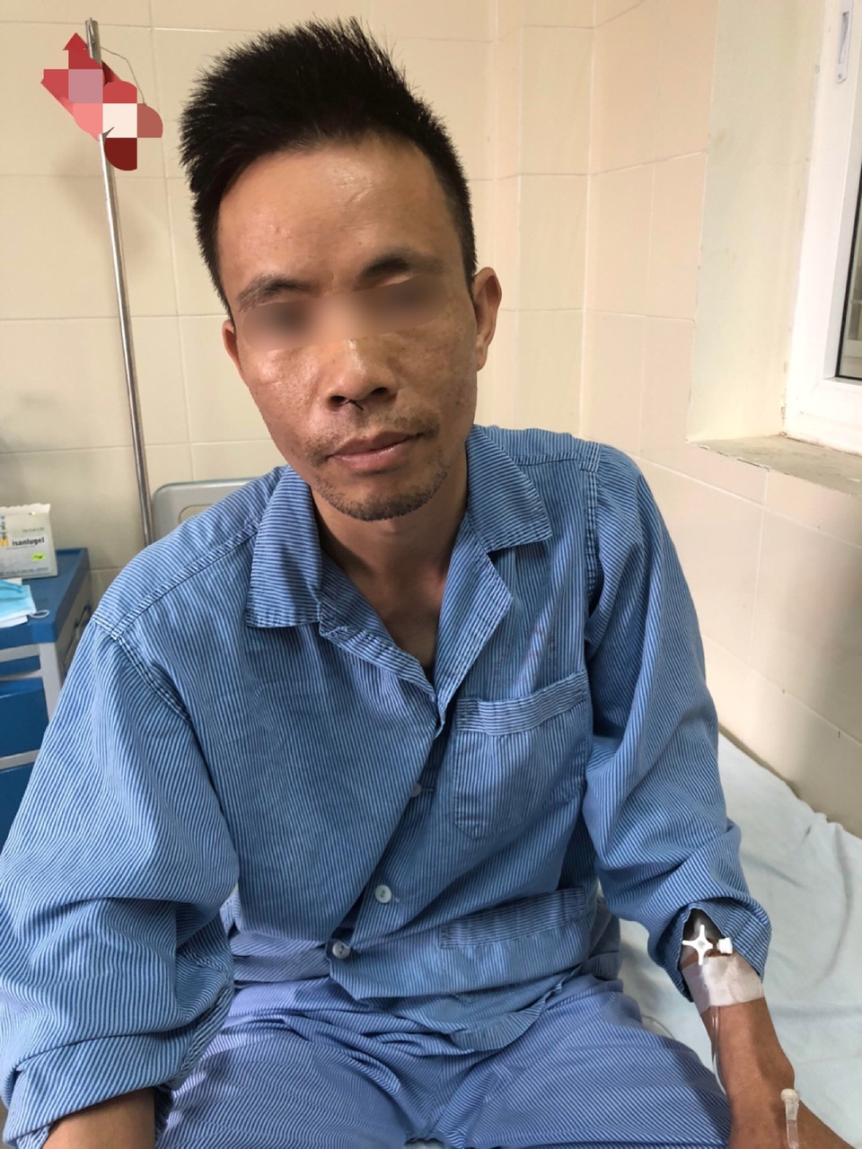 Đau đầu kéo dài, bàng hoàng phát hiện u não - 1 Bệnh nhân hồi phục sau một ngày được phẫu thuật nội soi qua đường mũi loại bỏ khối u não.