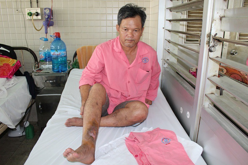 Thương người cha nghèo mong có 100 triệu đồng để cứu cẳng chân bị hoại tử - 2 Anh Tuấn hi vọng có thể chữa lành chân để đi làm kiếm tiền trả nợ và nuôi con ăn học