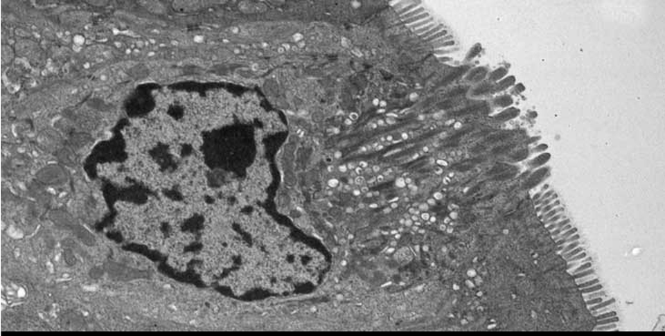 Đây là cách Norovirus xâm chiếm cơ thể - 2 Đây là cách Norovirus xâm chiếm cơ thể - 2