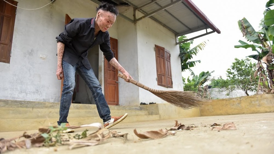 Cuộc sống lạc quan của 9x mắc bệnh "người cá" hiếm gặp ở Hà Nội - 7 Cách đây vài năm, Thọ học cách vào mạng, giao lưu kết bạn với mọi người, cuộc sống của cậu cũng dần trở nên lạc quan, cởi mở hơn. Để tự lo cho cuộc sống của mình, cậu xin bố mẹ ra ở riêng. Hàng ngày, Thọ trồng rau, nuôi lợn và lên mạng livestream truyền cảm hứng đến những người có chung nỗi đau bệnh tật như cậu.