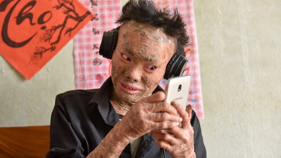 Cuộc sống lạc quan của 9x mắc bệnh "người cá" hiếm gặp ở Hà Nội - 9 9x người cá có khá nhiều tài lẻ, cậu có thể hát, làm thơ hoặc vẽ tranh. Thọ đầu tư sắm một bộ mic chuyên dụng và các thiết bị livestream phục vụ cho thú vui, đam mê của mình.