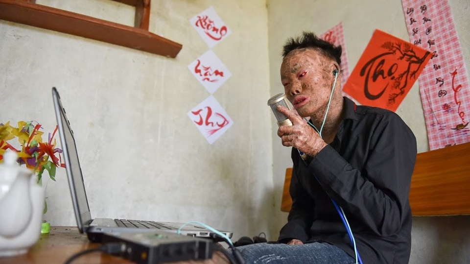 Cuộc sống lạc quan của 9x mắc bệnh "người cá" hiếm gặp ở Hà Nội - 10 
Chàng người cá “khoe”, cậu có thể hát 3 tiếng mà giọng không bị lạc hay hụt hơi.