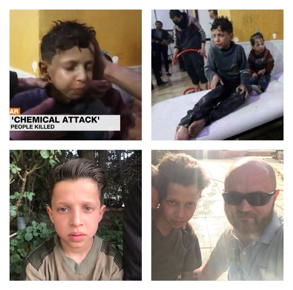 Truyền thông Nga tung bằng chứng vụ tấn công hóa học ở Syria nghi bị dàn dựng - 1 Cậu bé Hassan Diab, nhân chứng của vụ việc (Ảnh: Twitter)