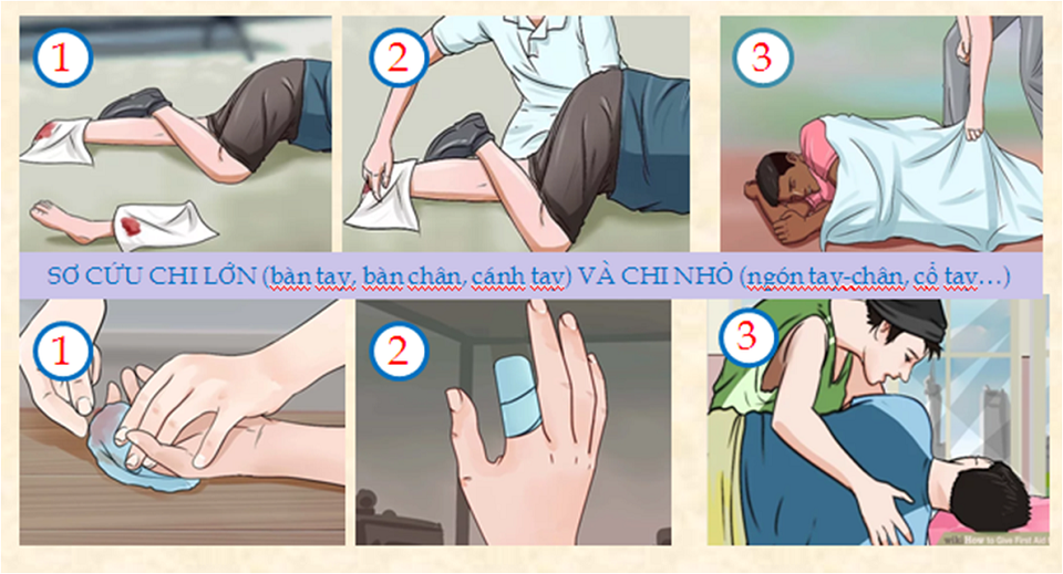 Cách xử trí người bị tai nạn đứt lìa một phần cơ thể - 2 Cách xử trí người bị tai nạn đứt lìa một phần cơ thể - 2