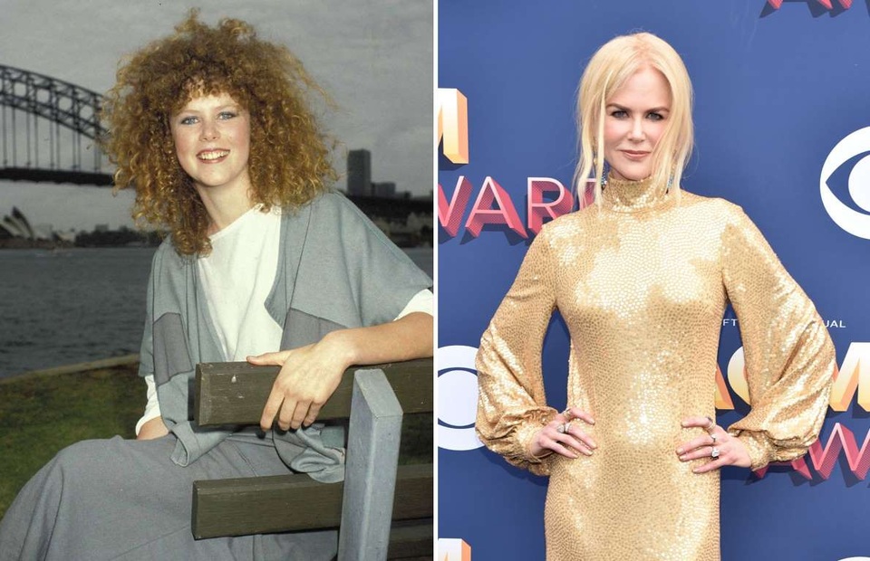 Nhan sắc những "Người đẹp nhất thế giới" ngày ấy và bây giờ - 17
Thiên nga nước Úc Nicole Kidman từng một lần giành danh hiệu Người đẹp nhất thế giới vào năm 2002. Thời gian khiến nhan sắc và gương mặt của Nicole thay đổi rất nhiều: từ năm 1983 (trái) và hiện tại 2018 (phải). Cô cũng là một trong những ngôi sao dính nghi án dao kéo thẩm mỹ nhiều nhất Hollywood.