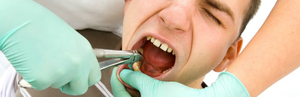 Ăn uống thế nào sau khi nhổ răng khôn? - 1 Ăn uống thế nào sau khi nhổ răng khôn? - 1