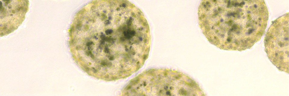 Thiết bị độc đáo cảnh báo ung thư qua... nốt ruồi - 2 Các tế bào dưới kính hiển vi cho thấy mức canxi bình thường (trái) và quá nhiều (phải) gây ra sự thay đổi màu sắc