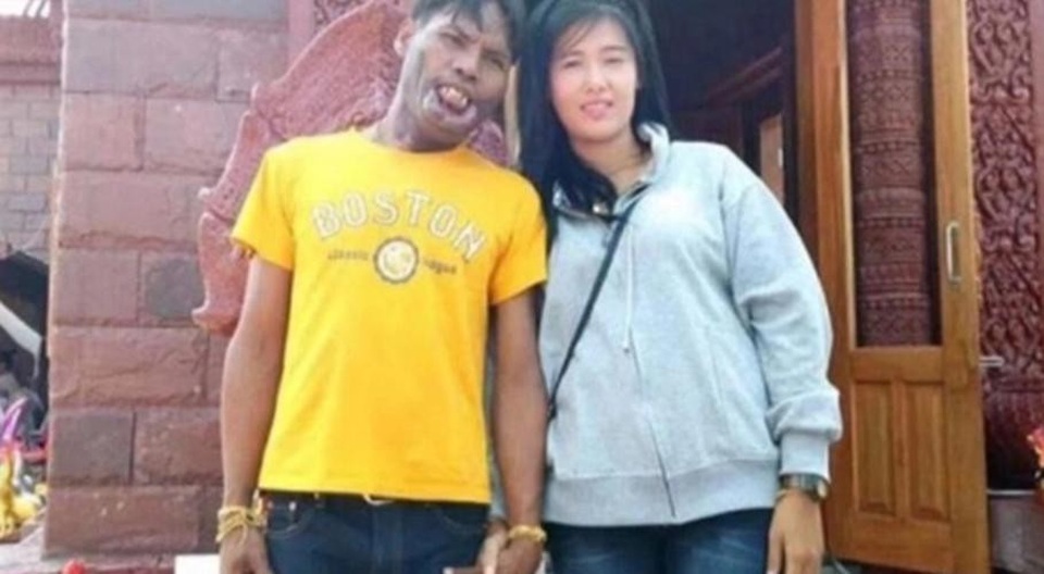 Chuyện tình người đẹp và anh chàng "quái thú" rung động hàng triệu con tim - 2 Nhan sắc chênh lệch của cặp đôi