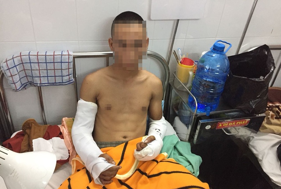 Nhóm thanh niên bị côn đồ truy sát dã man khi đang uống cà phê - 2 Anh Bùi V.T. bị chém đứt gân cả hai tay đang được điều trị tại bệnh viện.