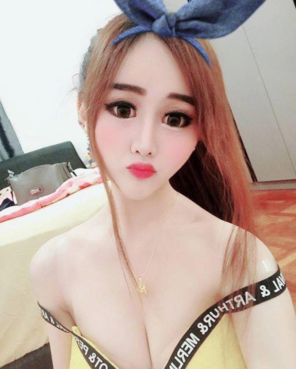 Sau phẫu thuật, Cammy đã mất kha khá người hâm mộ