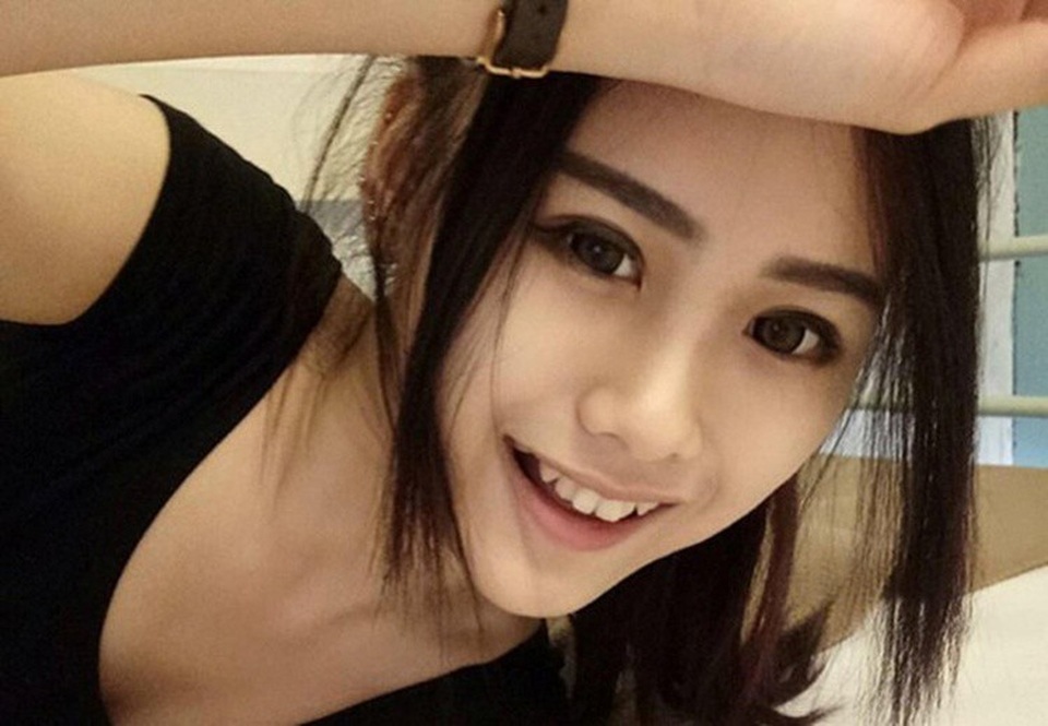 Ngoại hình ngọt ngào của Cammy trước khi phẫu thuật