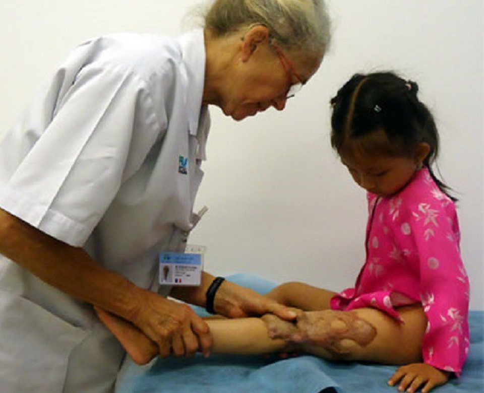 Phẫu thuật miễn phí các dị tật bẩm sinh cho trẻ em nghèo - 1 Một bệnh nhi đã được phẫu thuật dị tật nhờ thụ hưởng tài trợ từ quỹ
