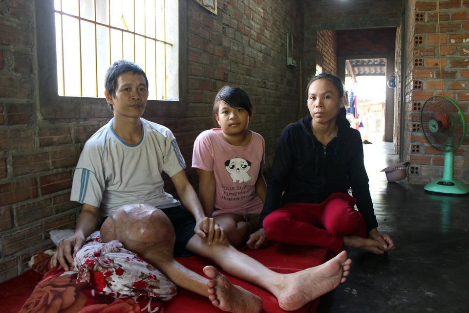 "Hàng ngày, tôi phải dùng đỉa hút máu chính mình cho... đỡ đau !" - 1 Anh Quy đang sống với vợ và con gái 10 tuổi trong 1 căn nhà cấp 4 đã xuống cấp