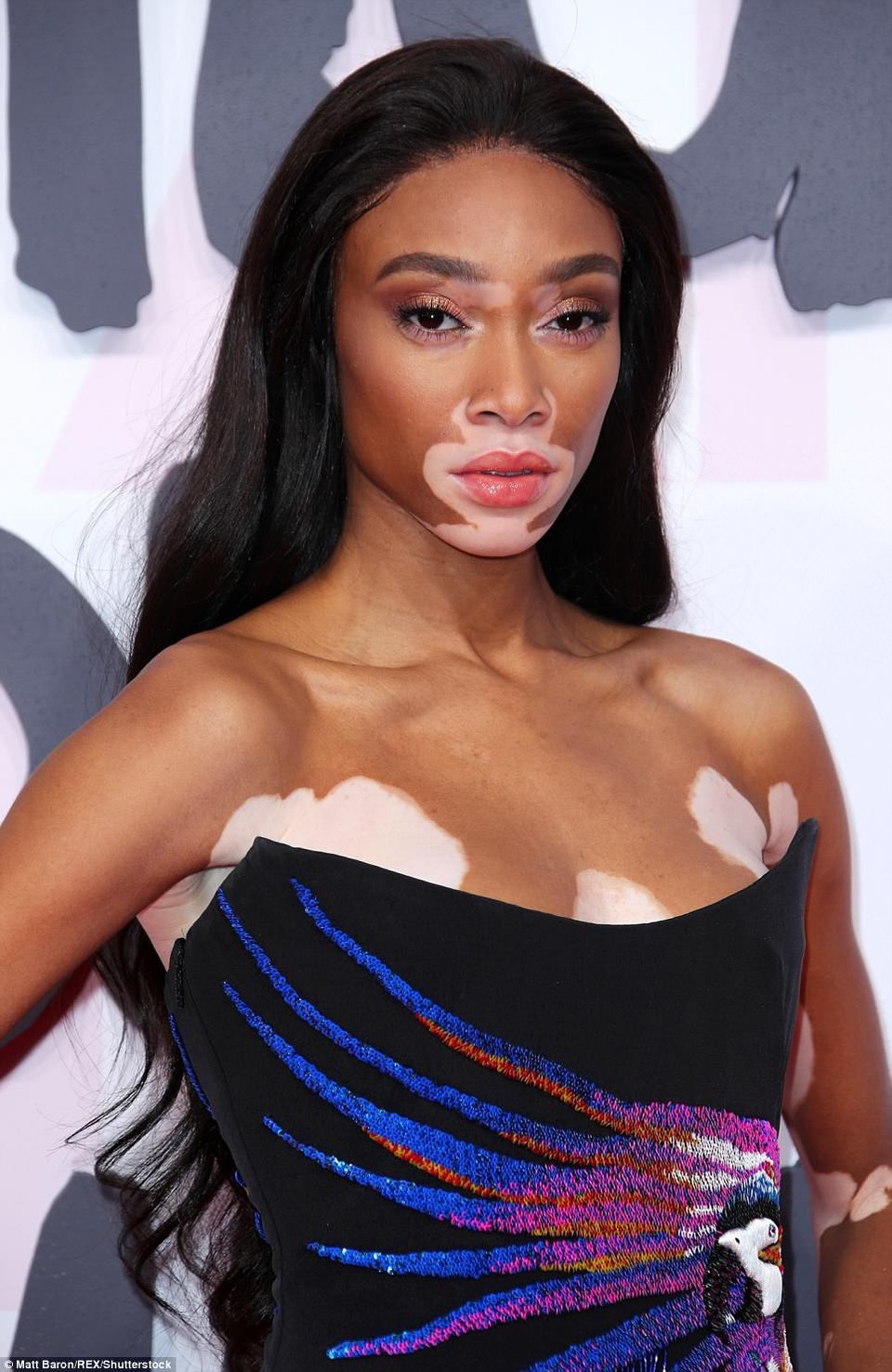 Người mẫu bạch biến hở bạo bên Bella Hadid - 13
Winnie Harlow từng khổ sở vì tuổi thơ bị bạn bè trêu chọc, xa lánh